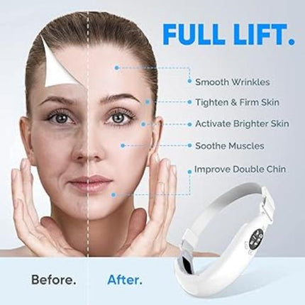 Schönheits-Facelift-Gerät – elektrische V-Linie – Doppelkinnverkleinerung – fortschrittliche Technologie